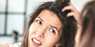 The symptoms of dandruff and ways to overcome it