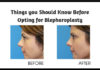 Things you Should Know Before Opting for Blepharoplasty1