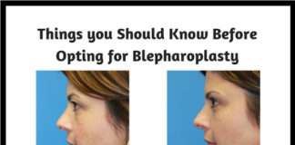 Things you Should Know Before Opting for Blepharoplasty1