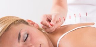 Acupuncture for Labour Induction