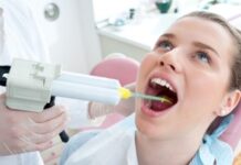 Health How to Take Care of Dental Filling