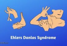 Recently Diagnosed with Ehlers Danlos Syndrome - These Tips Could Help You