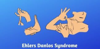 Recently Diagnosed with Ehlers Danlos Syndrome - These Tips Could Help You