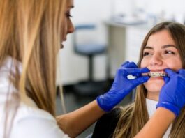 Tips for Choosing an Orthodontics in Surrey