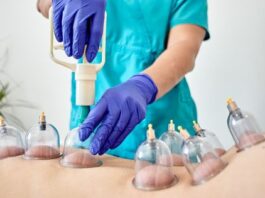 What Role Does Hijama Play in High Blood Pressure