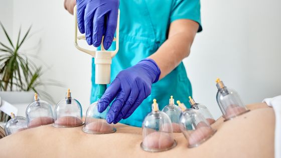 What Role Does Hijama Play in High Blood Pressure