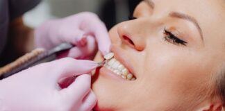 A Comprehensive Approach to Veneers: From Consultation to Maintenance